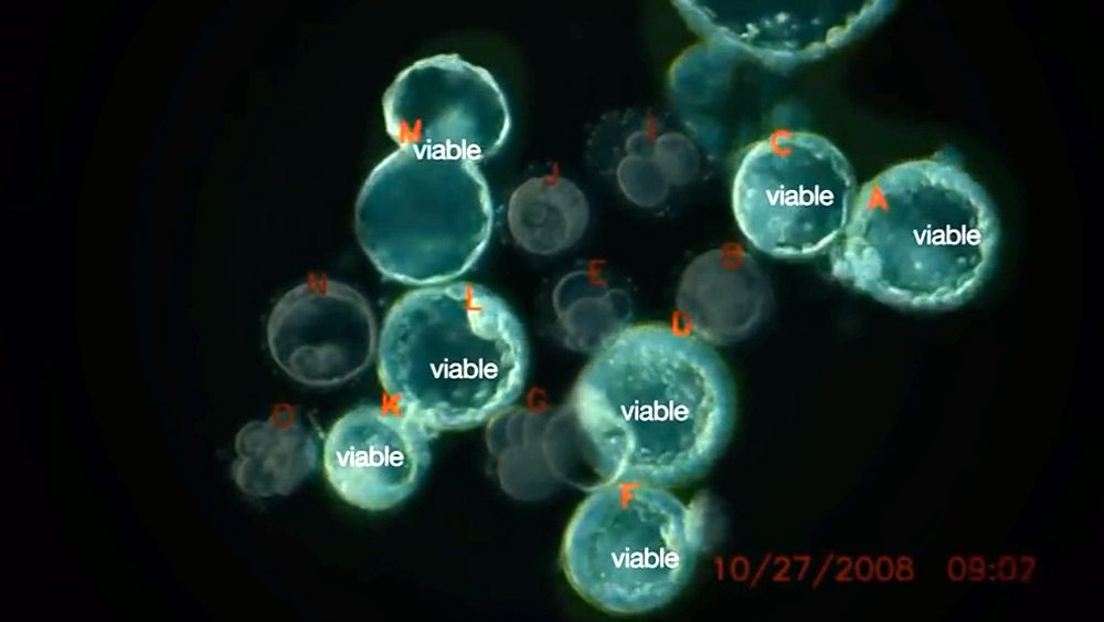 Which human embryos make it? | Aeon
